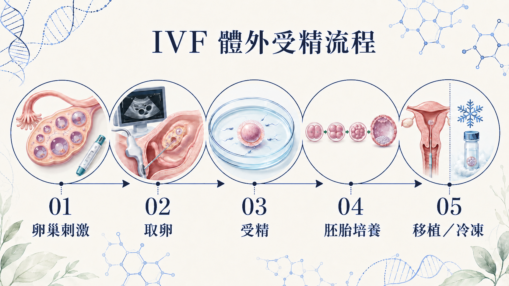 IVF 體外受精流程：卵巢刺激、取卵、受精、胚胎培養與移植或冷凍